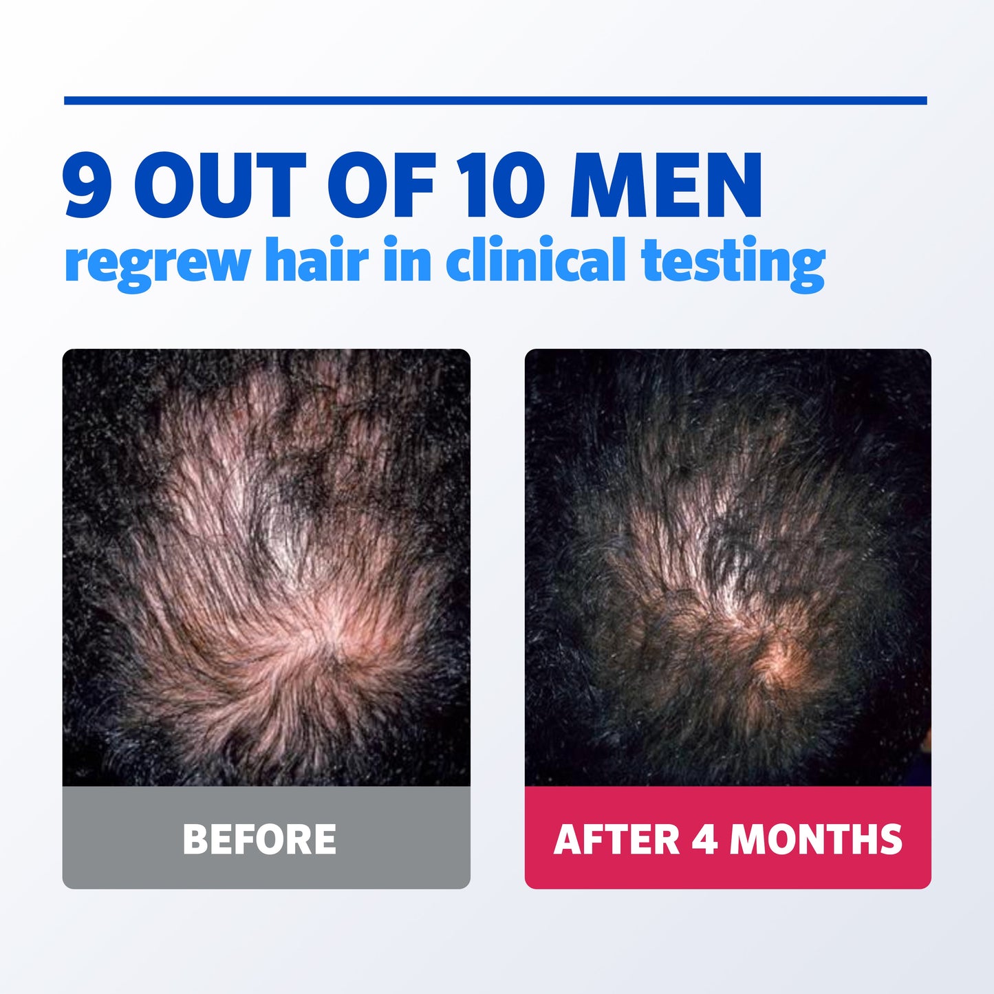 Korean Amino-Strength Complex™️ Hair Growth Serum